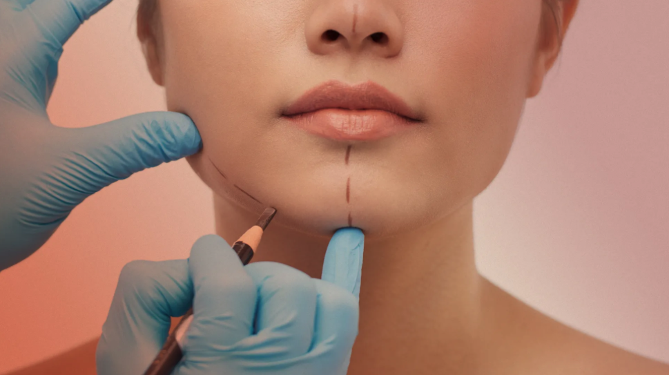 Plastic Surgery